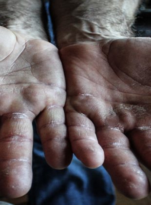 Working Hands, Winnipeg, MB, March, 2013